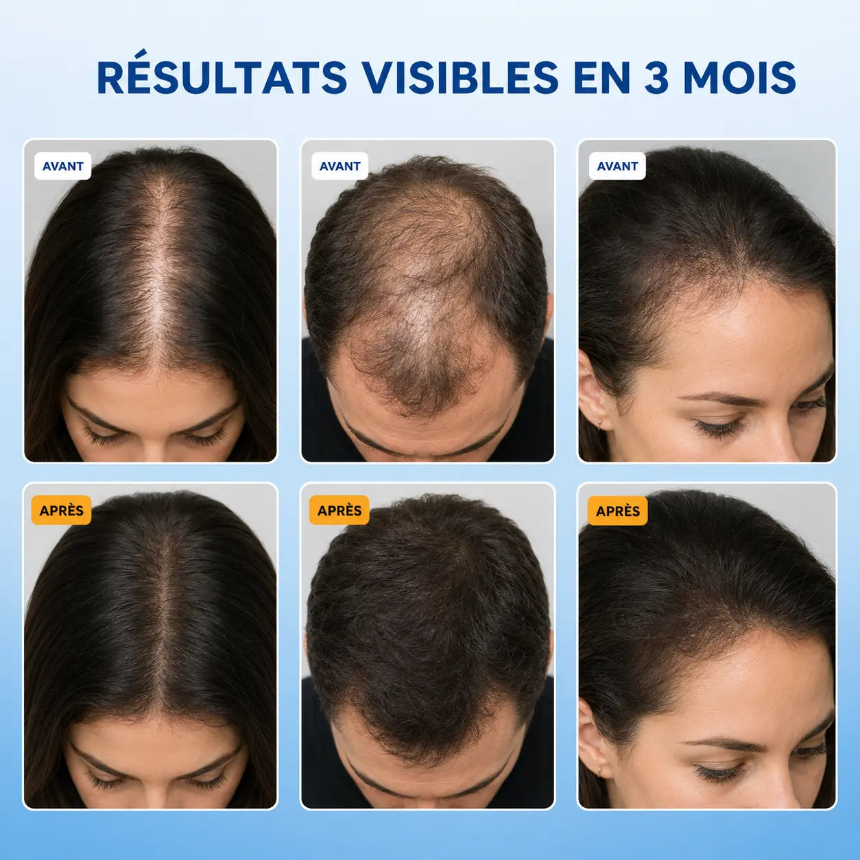 Novelya Sérum Anti-Chute & Repousse